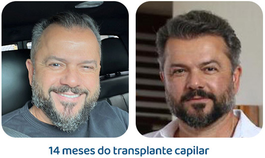 Masculino resultado 143