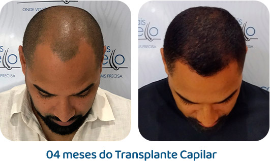 Masculino resultado 14