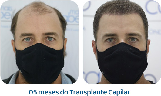 Masculino resultado 15