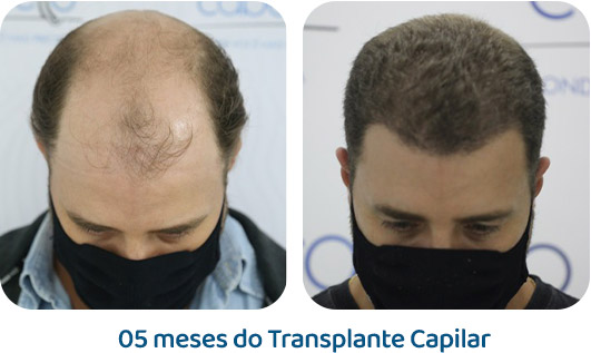 Masculino resultado 16