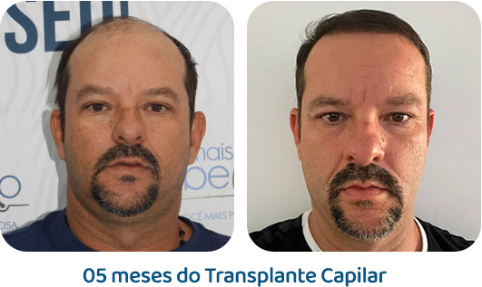 Masculino resultado 17