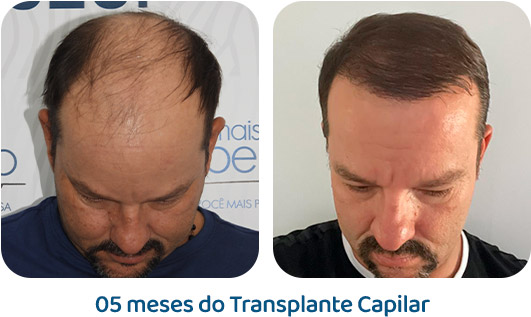 Masculino resultado 18