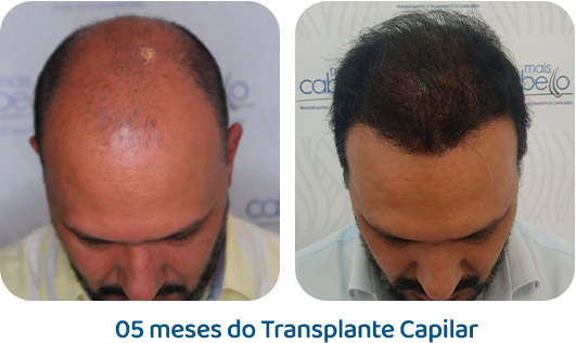 Masculino resultado 19