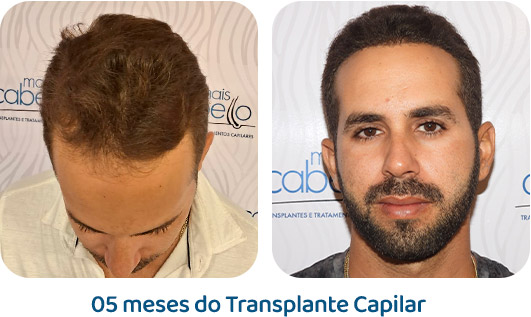 Masculino resultado 20