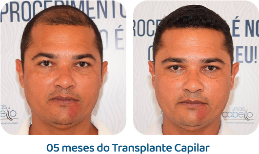 Masculino resultado 21