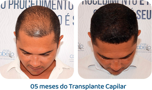 Masculino resultado 22