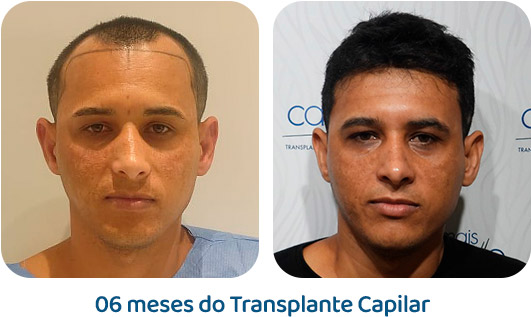 Masculino resultado 24