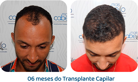 Masculino resultado 25