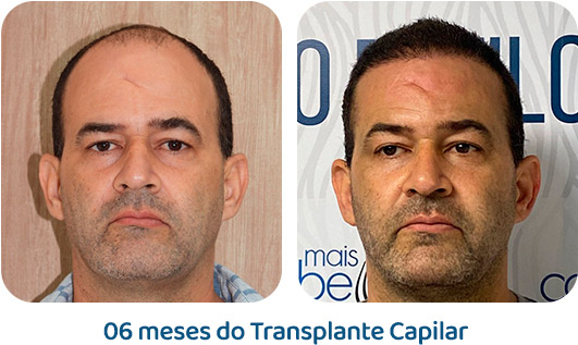 Masculino resultado 26