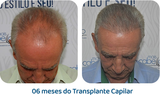 Masculino resultado 27