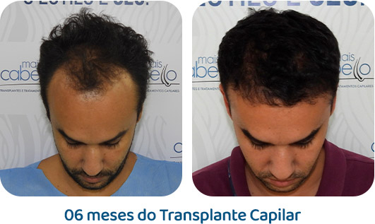 Masculino resultado 28