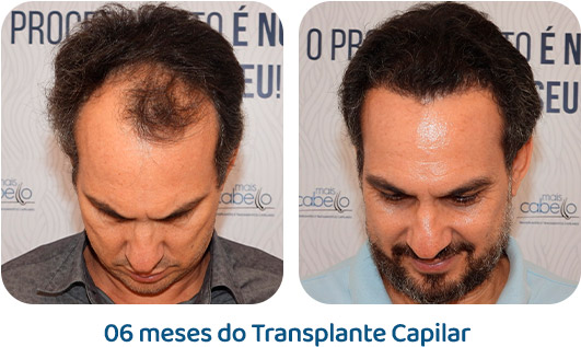 Masculino resultado 29