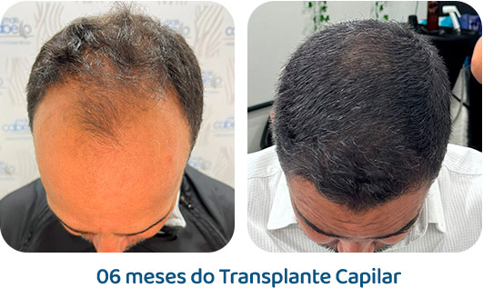 Masculino resultado 30