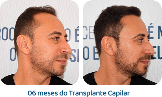 Masculino resultado 31