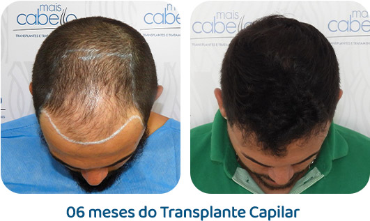 Masculino resultado 32