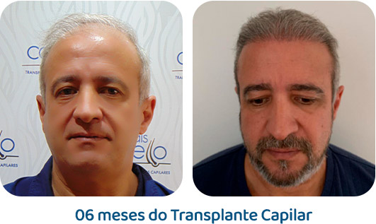 Masculino resultado 33
