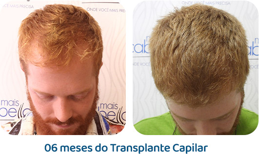 Masculino resultado 34