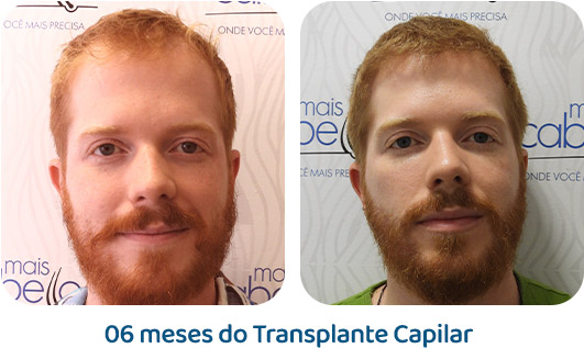 Masculino resultado 35