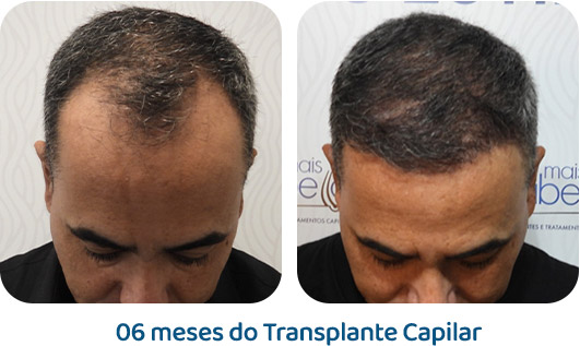 Masculino resultado 36