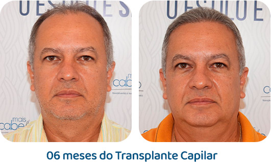 Masculino resultado 37
