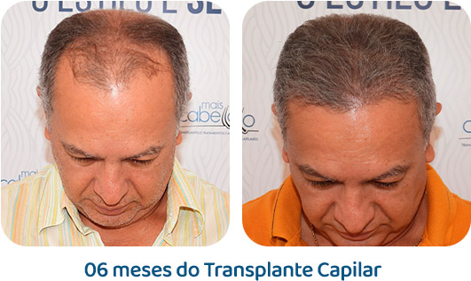 Masculino resultado 38