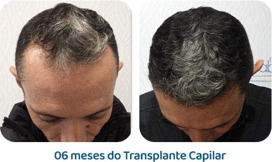 Masculino resultado 39