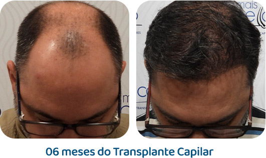 Masculino resultado 40