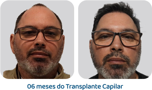 Masculino resultado 41