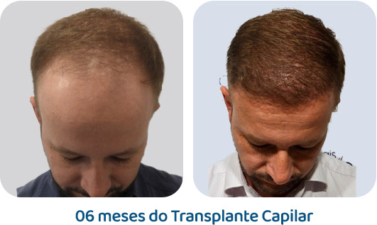 Masculino resultado 42