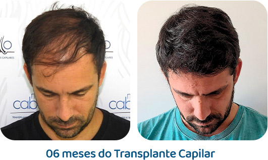 Masculino resultado 43