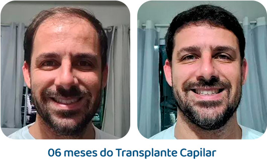 Masculino resultado 44