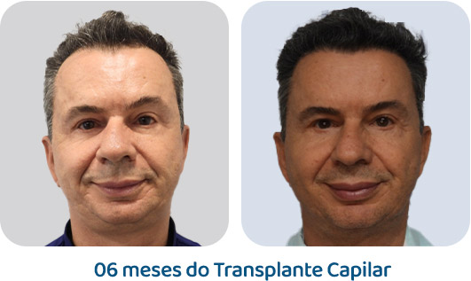 Masculino resultado 45