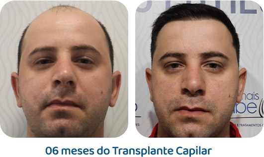 Masculino resultado 46