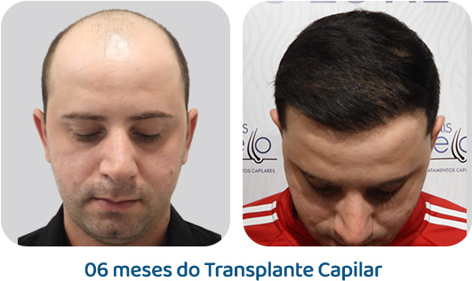 Masculino resultado 47