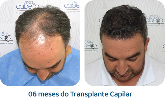 Masculino resultado 49