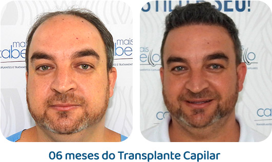 Masculino resultado 50