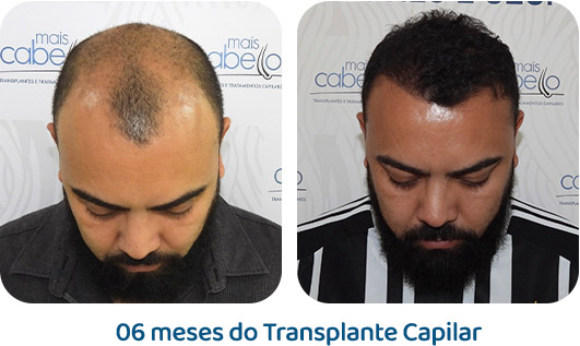 Masculino resultado 51
