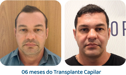 Masculino resultado 52