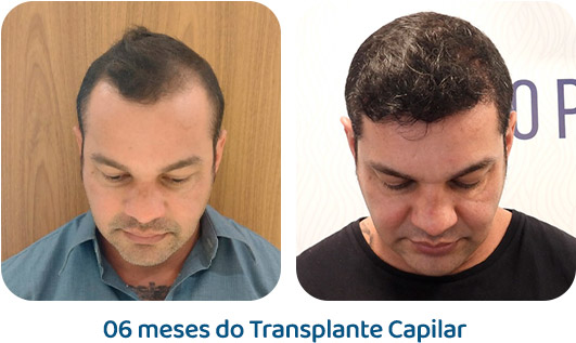 Masculino resultado 53