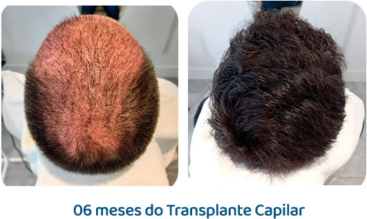 Masculino resultado 54