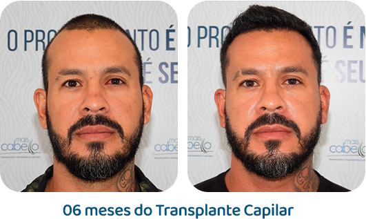 Masculino resultado 55