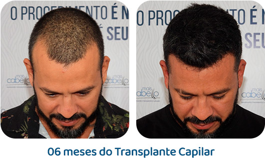 Masculino resultado 56