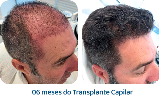 Masculino resultado 57