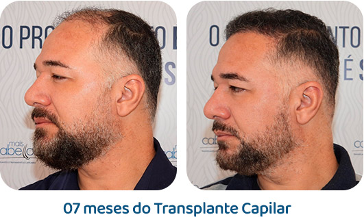 Masculino resultado 58