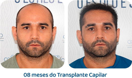 Masculino resultado 62