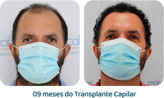 Masculino resultado 63