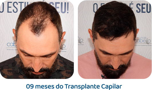 Masculino resultado 64