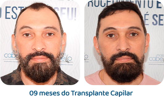 Masculino resultado 65