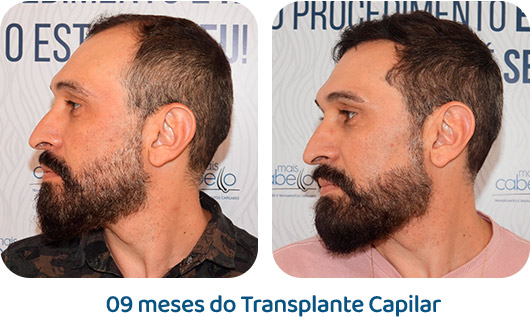 Masculino resultado 66