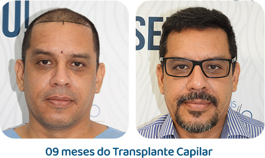 Masculino resultado 67